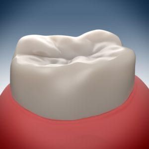 3-d rendering of a healthy molar